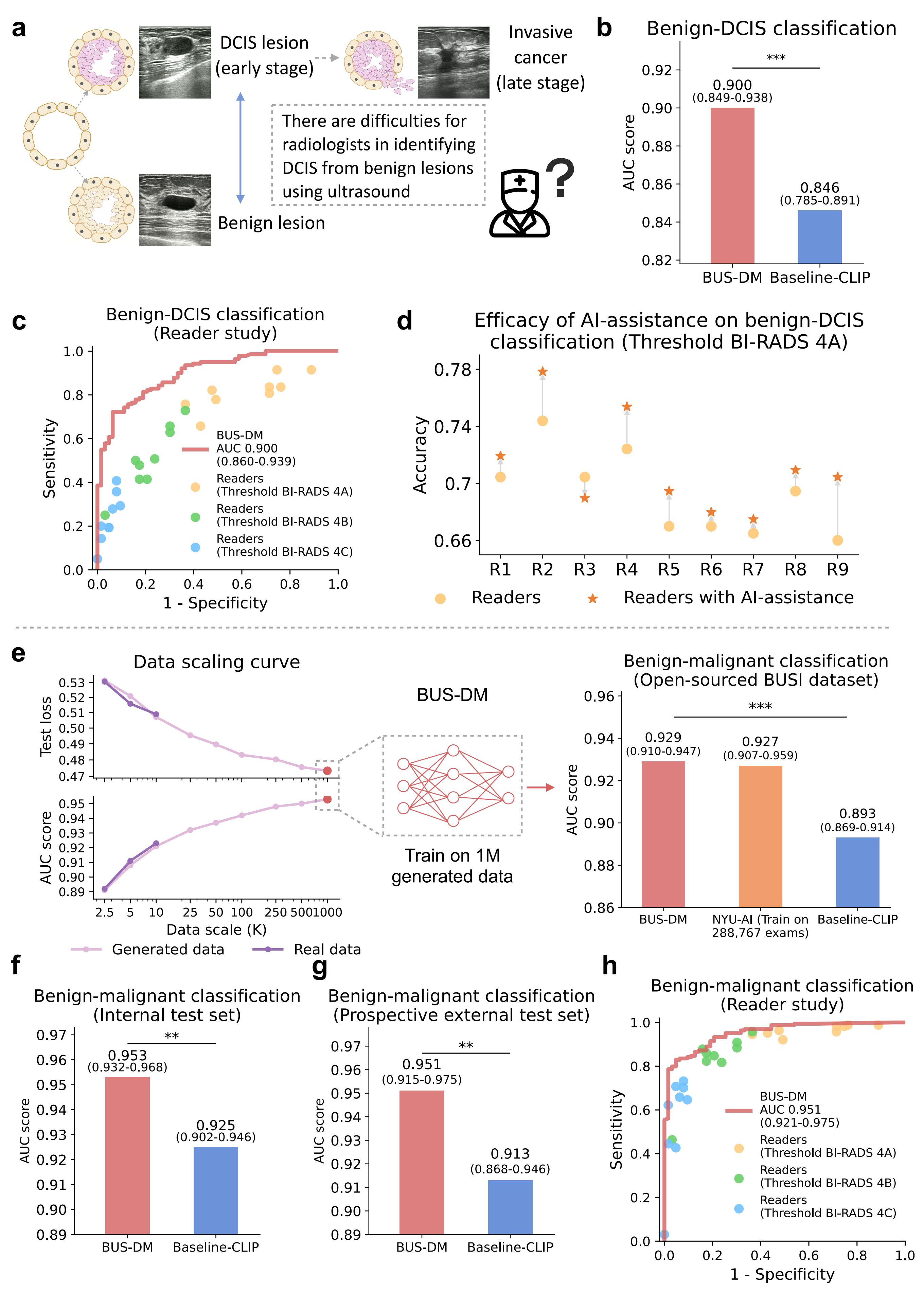 Breast ultrasound diagnosis