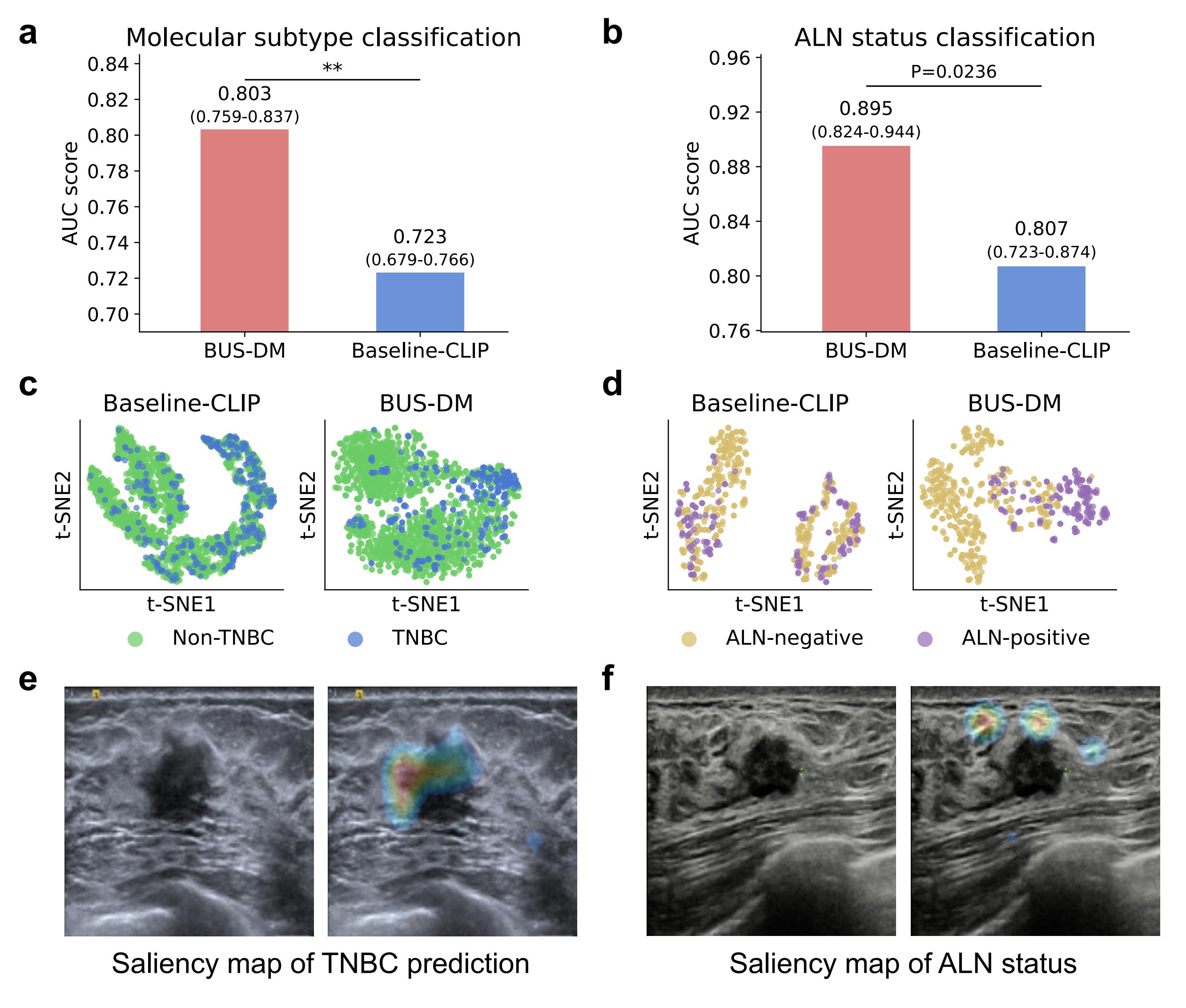 Breast cancer prognosis